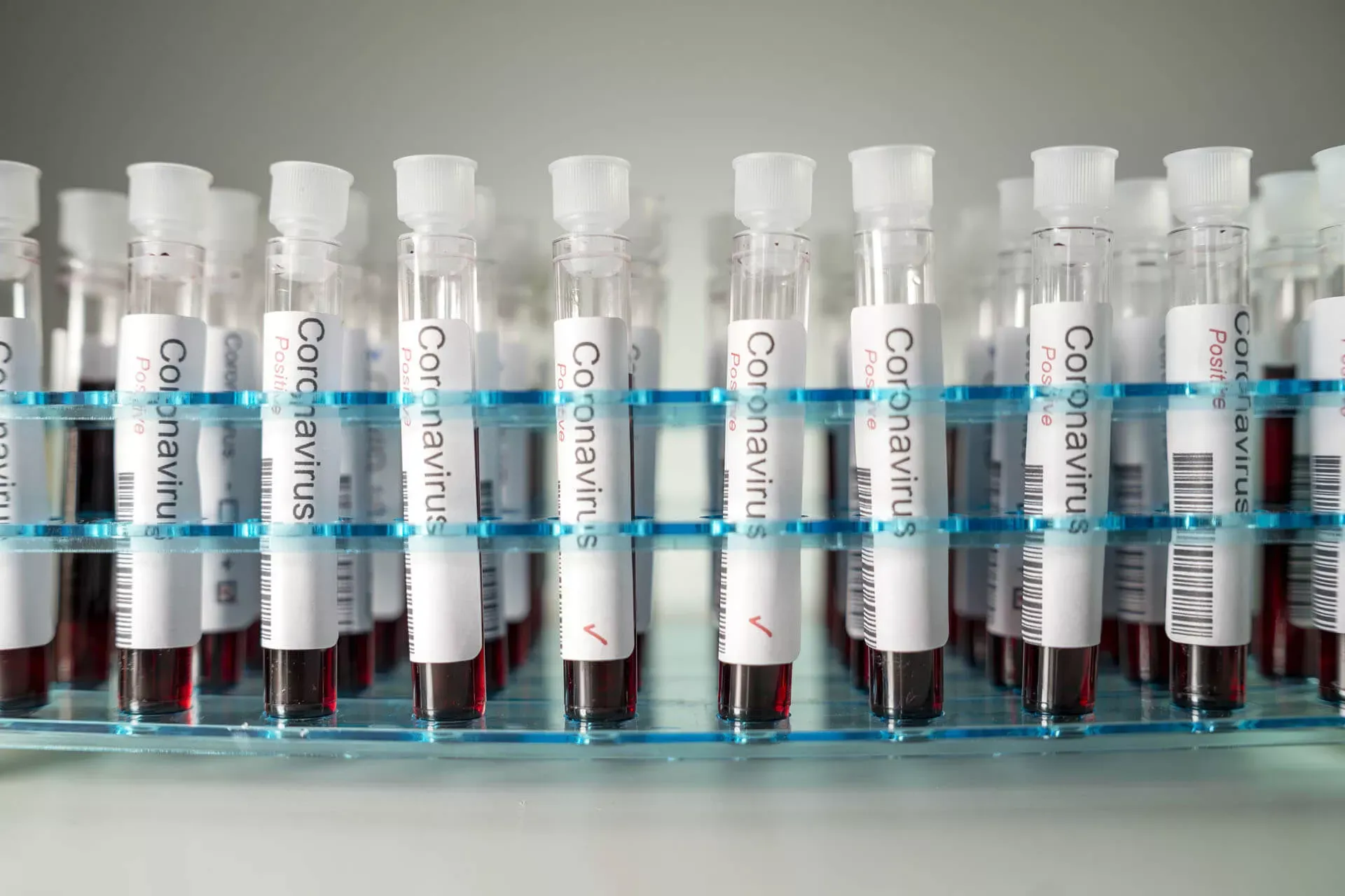 Ständer mit Teströhrchen gefüllt mit Blut, mit Aufklebern für positive Covid-19 Testung Ständer mit Teströhrchen gefüllt mit Blut, mit Aufklebern für positive Covid-19 Testung