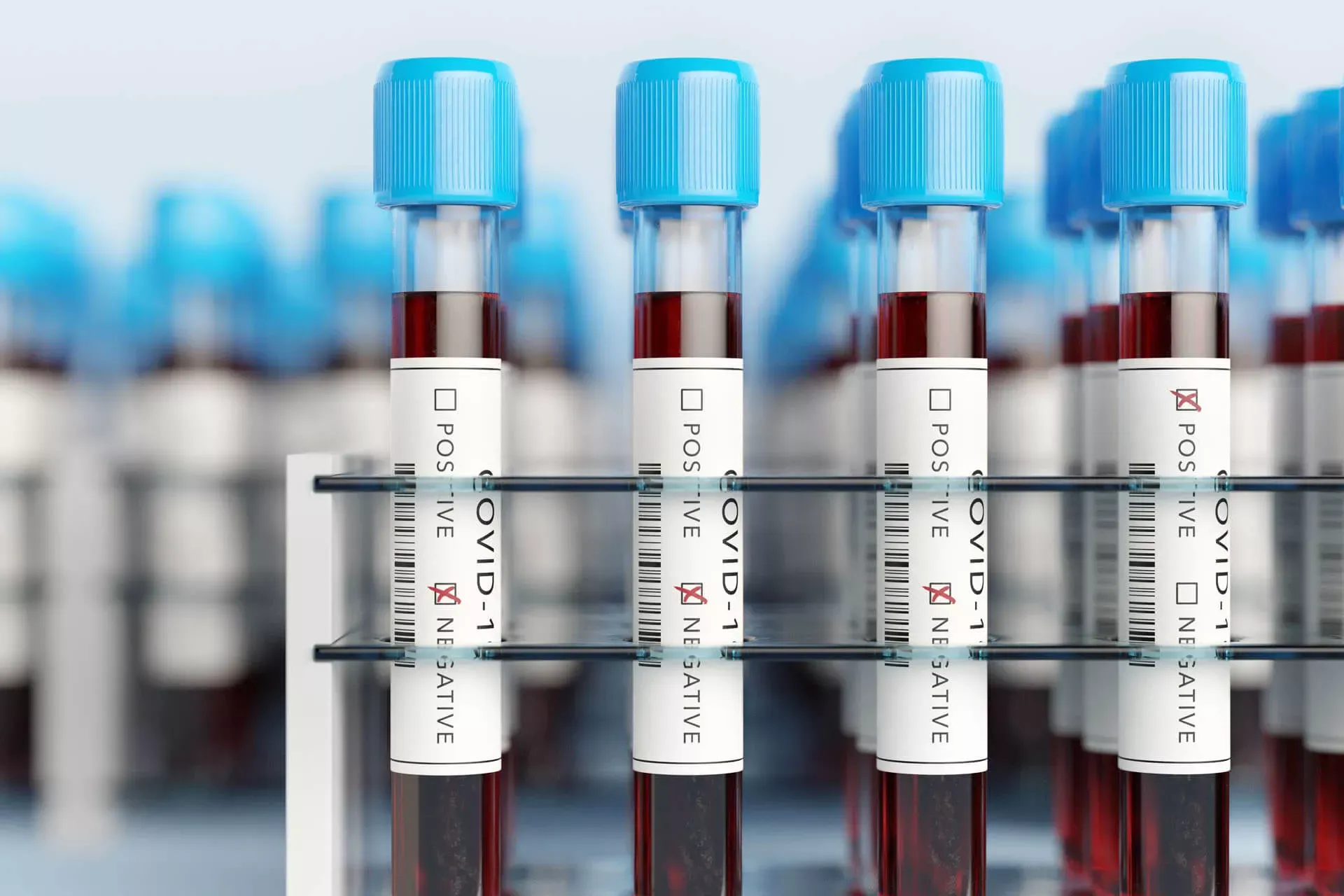 Behälter mit Teströhrchen mit Covid-19-Aufklebern, gefült mit Blut. Behälter mit Teströhrchen mit Covid-19-Aufklebern, gefült mit Blut.