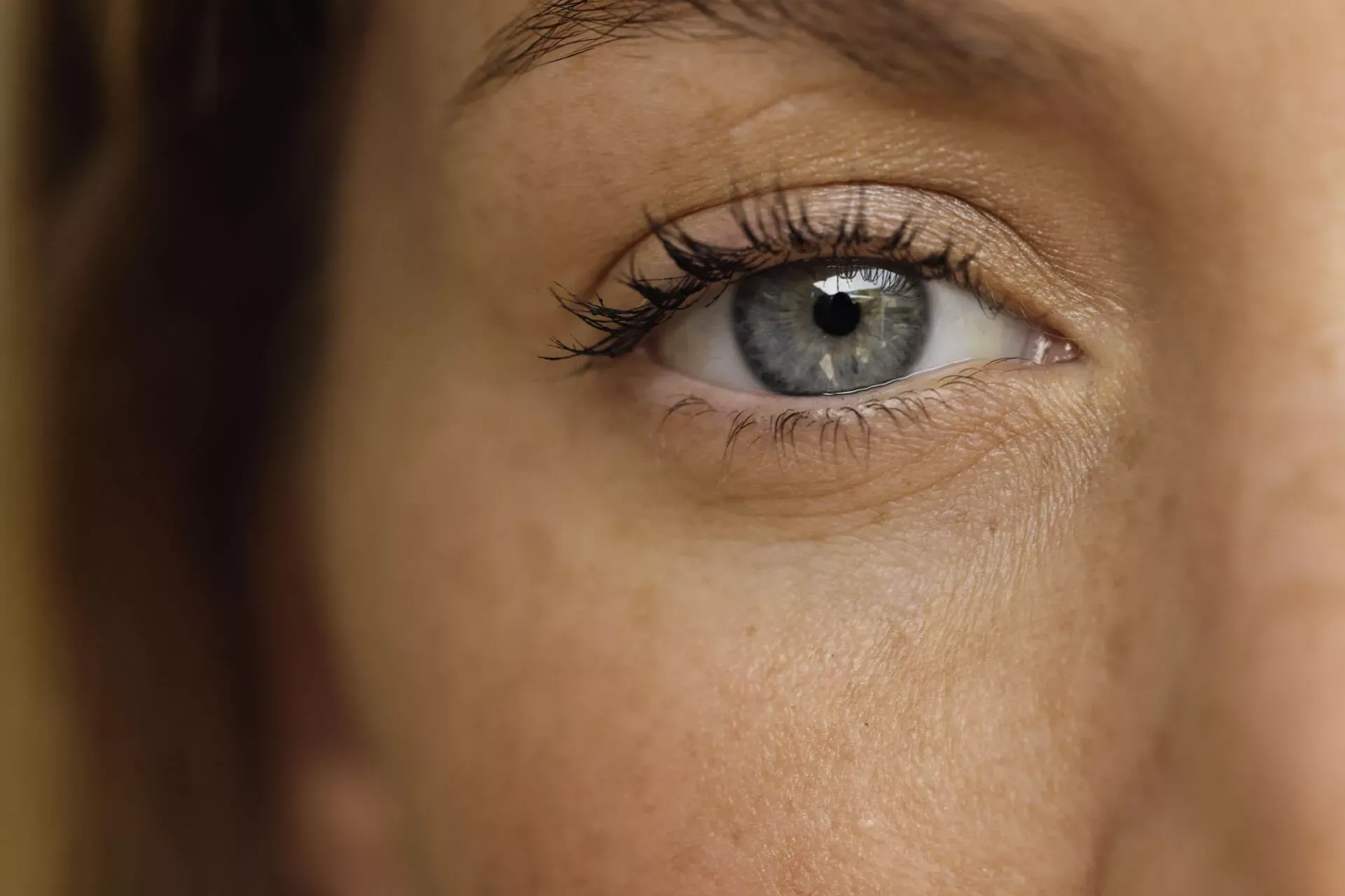 Gesicht einer Frau mit Sommersprossen und blauem Auge. Gesicht einer Frau mit Sommersprossen und blauem Auge.